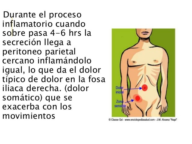 El tratamiento de la osteocondrosis moskva