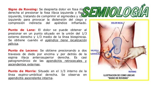 diabetes insípida fisiopatología central de la apéndice diabetes insípida fisiopatología central de la apéndice