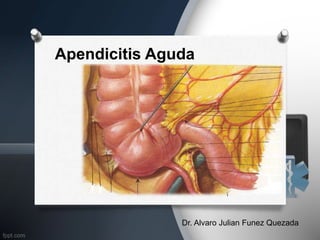 Apendicitis Aguda
1
Dr. Alvaro Julian Funez Quezada
 