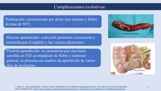 Complicaciones evolutivas:
1. Martin R. Acute appendicitis in adults: Clinical manifestations and differential diagnosis [Internet]. Up to date; 2018 [cited 28 September
2019]. Available from: https://www.uptodate.com/contents/acute-appendicitis-in-adults-clinical-manifestations-and-differential-diagnosis
30
Perforación: caracterizado por dolor mas intenso y fiebre
de mas de 38°C.
Absceso apendicular: colección purulenta circunscrita y
contenida por el epiplón y las viceras adyacentes.
Plastrón apendicular: se caracteriza por una masa
sensible en FID acompañado de fiebre y malestar
general, se presenta en cuadros de apendicitis de varios
días de evolución.
 