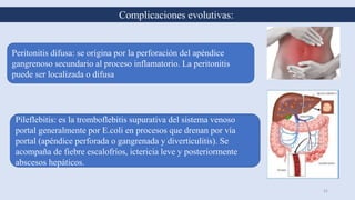 31
Complicaciones evolutivas:
Pileflebitis: es la tromboflebitis supurativa del sistema venoso
portal generalmente por E.coli en procesos que drenan por vía
portal (apéndice perforada o gangrenada y diverticulitis). Se
acompaña de fiebre escalofríos, ictericia leve y posteriormente
abscesos hepáticos.
Peritonitis difusa: se origina por la perforación del apéndice
gangrenoso secundario al proceso inflamatorio. La peritonitis
puede ser localizada o difusa
 