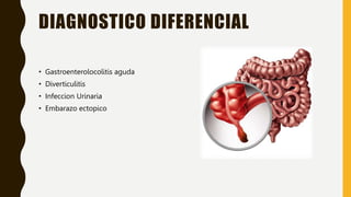 DIAGNOSTICO DIFERENCIAL
• Gastroenterolocolitis aguda
• Diverticulitis
• Infeccion Urinaria
• Embarazo ectopico
 