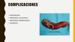 COMPLICACIONES
• PERFORACION
• PERITONITIS LOCALIZADA
• PERITONITIS GENERALIZADA
• PILIFEBLITIS
 