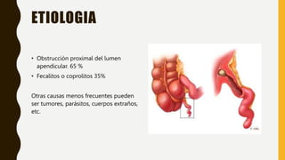 ETIOLOGIA
• Obstrucción proximal del lumen
apendicular. 65 %
• Fecalitos o coprolitos 35%
Otras causas menos frecuentes pueden
ser tumores, parásitos, cuerpos extraños,
etc.
 