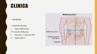 CLINICA
• ANOREXIA
• Triada De Murphy
I. Dolor Abdominal
 Punto De McBurney
I. Nauseas Y Vómitos 60%
II. Fiebre 38,3°C
 