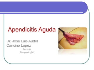 Apendicitis Aguda
Dr. José Luis Audel
Cancino López
Docente
Fisiopatología I
 