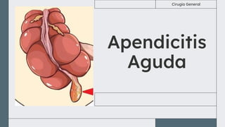 Apendicitis
Aguda
Cirugía General
 