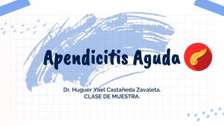 Dr. Huguer Yael Castañeda Zavaleta.
CLASE DE MUESTRA.
Apendicitis Aguda
 