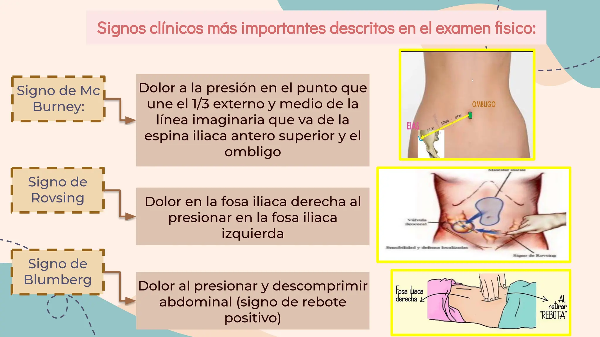 APENDICITIS AGUDA.en cirugia exposicion teorica | PDF