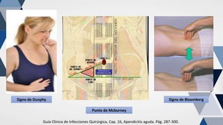 Apendicitis Aguda.pptx manejo quirúrgico | PPTX