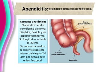 Apendicitis:Inflamación aguda del apendice cecal.
Recuento anatómico:
El apéndice cecal o
vermiforme de forma
cilíndrica, flexible y de
aspecto vermiforme.
Su longitud es variable
(5-20cm).
Se encuentra unido a
la superficie postero-
interna del ciego a 2 ó
3cm por debajo de la
unión íleo cecal.
 