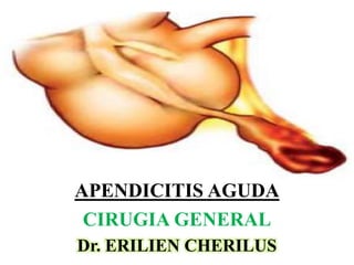 Dr. ERILIEN CHERILUS
APENDICITIS AGUDA
CIRUGIA GENERAL
 