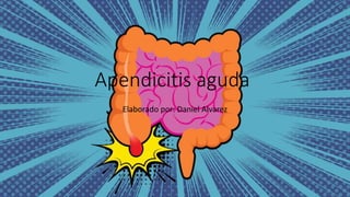 Apendicitis aguda
Elaborado por: Daniel Alvarez
 
