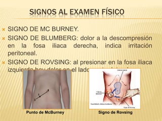 SIGNOS AL EXAMEN FÍSICO

   SIGNO DE MC BURNEY.
   SIGNO DE BLUMBERG: dolor a la descompresión
    en la fosa iliaca derecha, indica irritación
    peritoneal.
   SIGNO DE ROVSING: al presionar en la fosa iliaca
    izquierda hay dolor en el lado contra lateral.




          Punto de McBurney       Signo de Rovsing
 