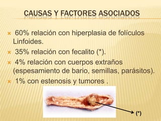 CAUSAS Y FACTORES ASOCIADOS

 60% relación con hiperplasia de folículos
 Linfoides.
 35% relación con fecalito (*).

 4% relación con cuerpos extraños
 (espesamiento de bario, semillas, parásitos).
 1% con estenosis y tumores .




                                        (*)
 