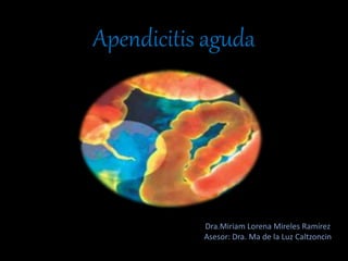 Apendicitis aguda
Dra.Miriam Lorena Mireles Ramírez
Asesor: Dra. Ma de la Luz Caltzoncin
 