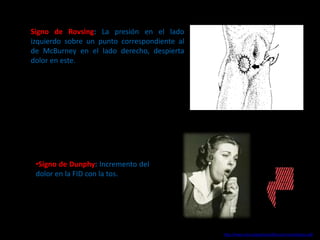 Apendicitis aguda diverticulo meckel | PPTX