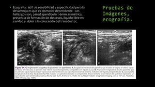 Pruebas de
Imágenes,
ecografía.
• Ecografia: 90% de sensibilidad y especificidad pero la
desventaja es que es operador dependiente. Los
hallazgos son, pared apendicular >6mm asimétrica,
presencia de formación de abscesos, liquido libre en
cavidad y dolor a la colocación del transductor,
 