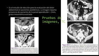 Pruebas de
imágenes, TC
• Es el estudio de elección para la evaluación del dolor
abdominal en pacientes pediátricos. La imagen reporta
presencia de aumento de la pared apendicular > 7mm,
grasa mesentérica estriada
 