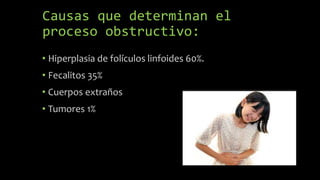 Causas que determinan el
proceso obstructivo:
• Hiperplasia de folículos linfoides 60%.
• Fecalitos 35%
• Cuerpos extraños
• Tumores 1%
 