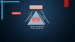 SIGNOS:
Triada de
Dieulafoy
3)Dolor a la presión en
el punto Mc Burney
 