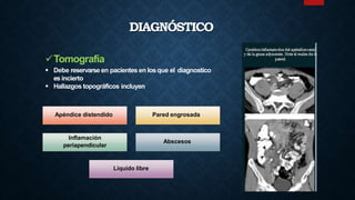 Tomografía
 Debe reservarse en pacientes en losque el diagnostico
es incierto
 Hallazgos topográficos incluyen
Apéndice distendido Pared engrosada
Inflamación
periapendicular
Abscesos
Liquido libre
DIAGNÓSTICO
 