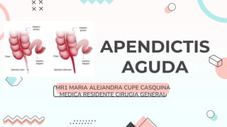 APENDICTIS
AGUDA
MR1 MARIA ALEJANDRA CUPE CASQUINA
MEDICA RESIDENTE CIRUGIA GENERAL
 
