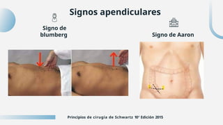 Apendicitis_aguda_y_plastrón_apendicular ACTUALIZADO.pptx
