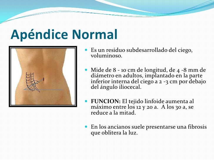 Apendicitis buena1 Apendicitis buena1