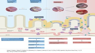 Appendix Nature Comprehensive Overview of Appendicitis: Pathophysiology, Diagnosis, and ...