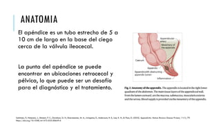 Comprehensive Overview of Appendicitis: Pathophysiology, Diagnosis, and ...