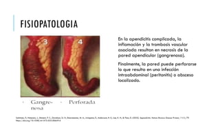 Comprehensive Overview of Appendicitis: Pathophysiology, Diagnosis, and ...