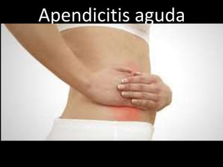 Apendicitis aguda

 