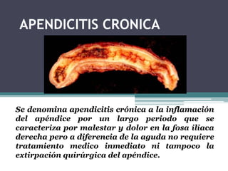 APENDICITIS CRONICA 
Se denomina apendicitis crónica a la inflamación 
del apéndice por un largo periodo que se 
caracteriza por malestar y dolor en la fosa iliaca 
derecha pero a diferencia de la aguda no requiere 
tratamiento medico inmediato ni tampoco la 
extirpación quirúrgica del apéndice. 
 