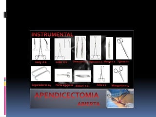 Apendicitis dr acuña