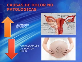 LIGAMENTO
REDONDO
CONTRACCIONES
DE BRAXTON
HICKS
 