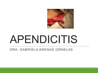 APENDICITIS
DRA. GABRIELA ARENAS ORNELAS
 