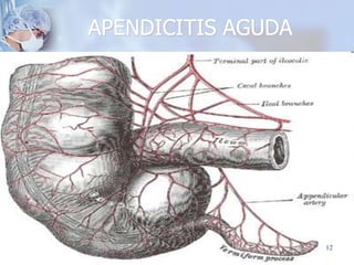 APENDICITIS AGUDA
12
 