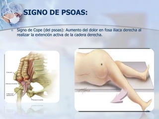 SIGNO DE PSOAS:
 Signo de Cope (del psoas): Aumento del dolor en fosa iliaca derecha al
realizar la extención activa de l...