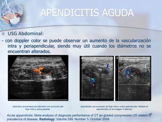  USG Abdominal:
- con doppler color se puede observar un aumento de la vascularización
intra y periapendicular, siendo mu...