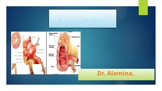 Comprehensive Overview of Acute Appendicitis: Diagnosis, Treatment, and ...