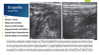 Ecografía
Sensib 95%
 Dx
 Grosor > 6mm
 Distención luminal
 Masa en FID Fecalito
 Engrosamiento asimétrico
 Liquido libre intraperitoneal
 Edema tejido circundante
 