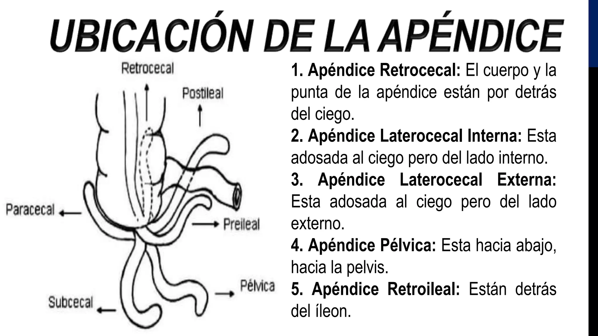 APENDICITIS Punto Jhosmer pptx