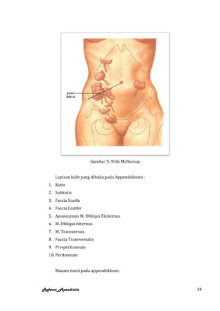 Gambar 5. Titik McBurnay


      Lapisan kulit yang dibuka pada Appendektomi :
   1. Kutis
   2. Subkutis
   3. Fascia Scarfa
   4. Fascia Camfer
   5. Aponeurosis M. Obliqus Eksternus
   6. M. Obliqus Internus
   7. M. Transversus
   8. Fascia Transversalis
   9. Pre-peritoneum
   10. Peritoneum


      Macam insisi pada appendektomi:



Referat_Apendisitis                                   34
 
