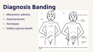 Comprehensive Pediatric Acute Abdominal Pain and Appendicitis Diagnosis ...