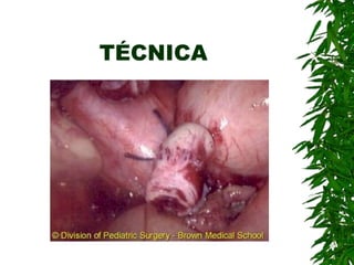 TÉCNICA
 
