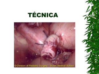TÉCNICA
 
