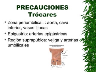 PRECAUCIONES
Trócares
 Zona periumbilical: : aorta, cava
inferior, vasos ilíacas
 Epigastrio: arterias epigástricas
 Región suprapúbica: vejiga y arterias
umbilicales
 