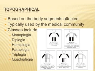 TOPOGRAPHICAL
 Based on the body segments affected
 Typically used by the medical community
 Classes include:
 Monoplegia
 Diplegia
 Hemiplegia
 Paraplegia
 Triplegia
 Quadriplegia
 