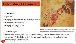 10
I. Specimen
 Sputum
 Biopsy material from pulmonary disease
 Bone marrow aspirate
 Biopsy of lymph node
II. Microscopy
 Giemsa stain/Wright’s stain: (Sputum/ Pus); Grocott-Gomori methenamine
silver stain & PAS (Biopsies) shows small, oval yeast cells packed within
macrophages or monocytes.
Laboratory Diagnosis
 